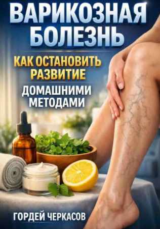 Варикозная болезнь